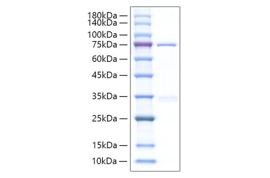 SDS-PAGE - Recombinant Human CYR61 Protein (C-terminal Human Fc Tag) (A330512) - Antibodies.com