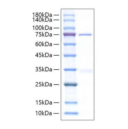 SDS-PAGE - Recombinant Human CYR61 Protein (C-terminal Human Fc Tag) (A330512) - Antibodies.com