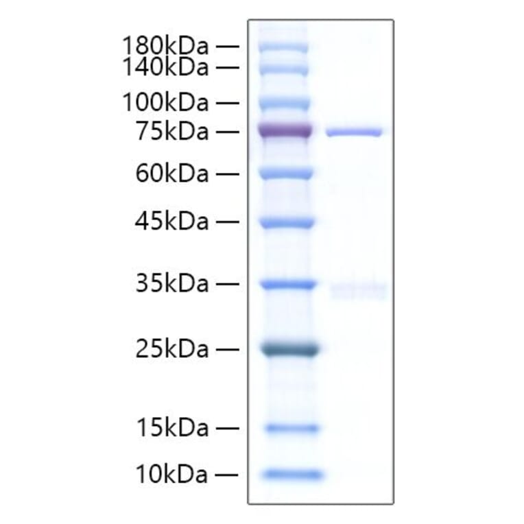 SDS-PAGE - Recombinant Human CYR61 Protein (C-terminal Human Fc Tag) (A330512) - Antibodies.com