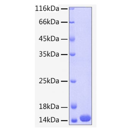 SDS-PAGE - Recombinant Human Cystatin A Protein (C-terminal His Tag) (A330513) - Antibodies.com