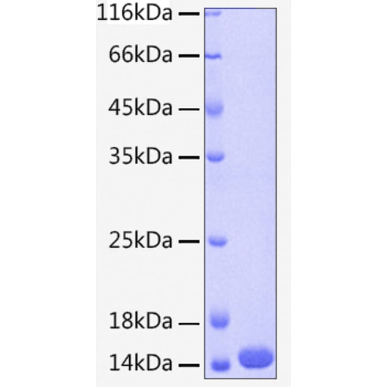 SDS-PAGE - Recombinant Human Cystatin A Protein (C-terminal His Tag) (A330513) - Antibodies.com