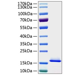 SDS-PAGE - Recombinant Human Cystatin C Protein (C-terminal His Tag) (A330514) - Antibodies.com