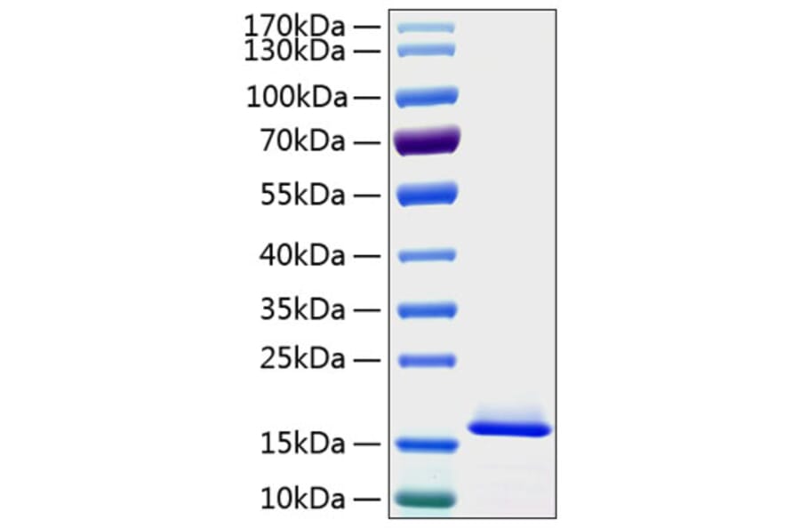 SDS-PAGE - Recombinant Human Cystatin C Protein (C-terminal His Tag) (A330514) - Antibodies.com