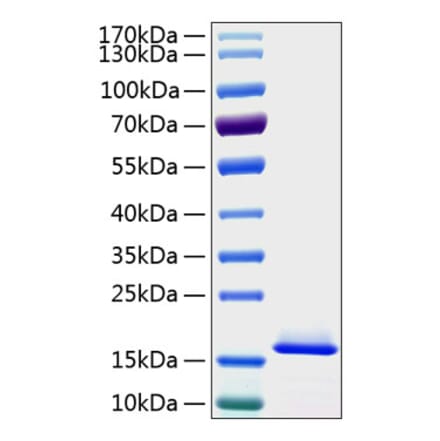 SDS-PAGE - Recombinant Human Cystatin C Protein (C-terminal His Tag) (A330514) - Antibodies.com