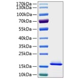 SDS-PAGE - Recombinant Human Cystatin C Protein (C-terminal His Tag) (A330514) - Antibodies.com