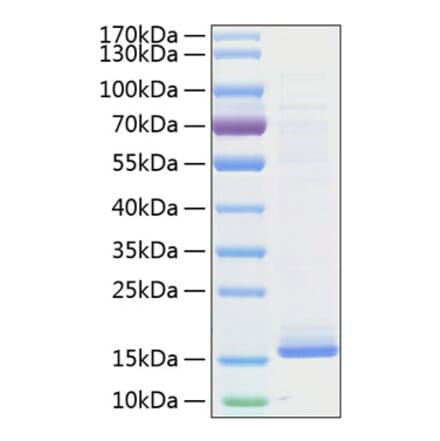 SDS-PAGE - Recombinant Human Cystatin D Protein (C-terminal His Tag) (A330515) - Antibodies.com