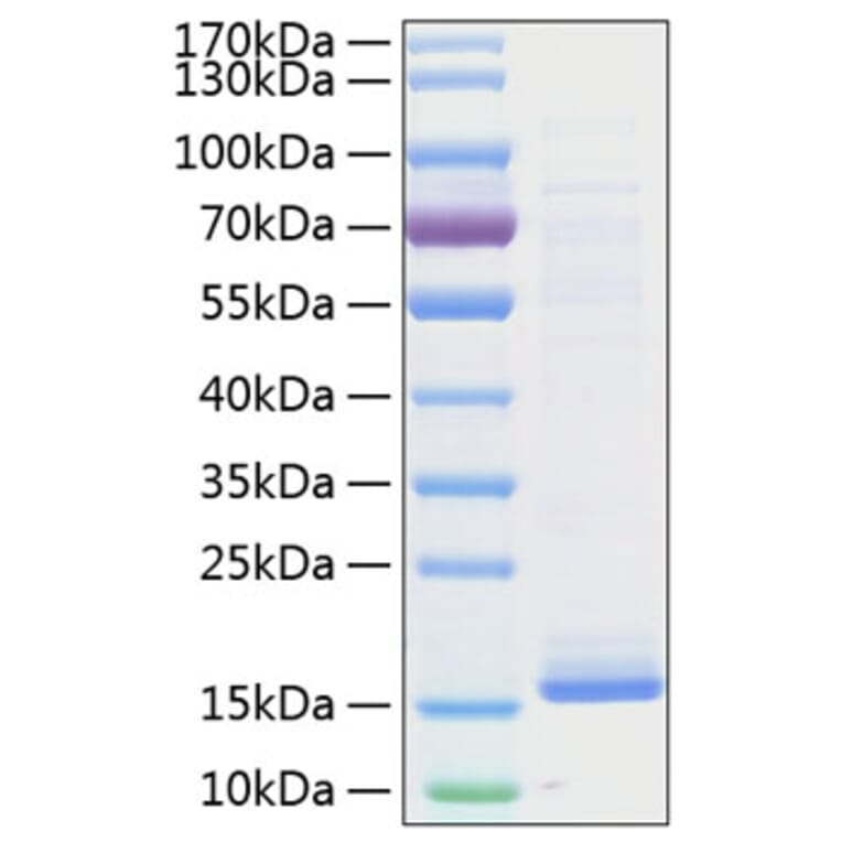 SDS-PAGE - Recombinant Human Cystatin D Protein (C-terminal His Tag) (A330515) - Antibodies.com