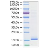 SDS-PAGE - Recombinant Human Cystatin D Protein (C-terminal His Tag) (A330515) - Antibodies.com