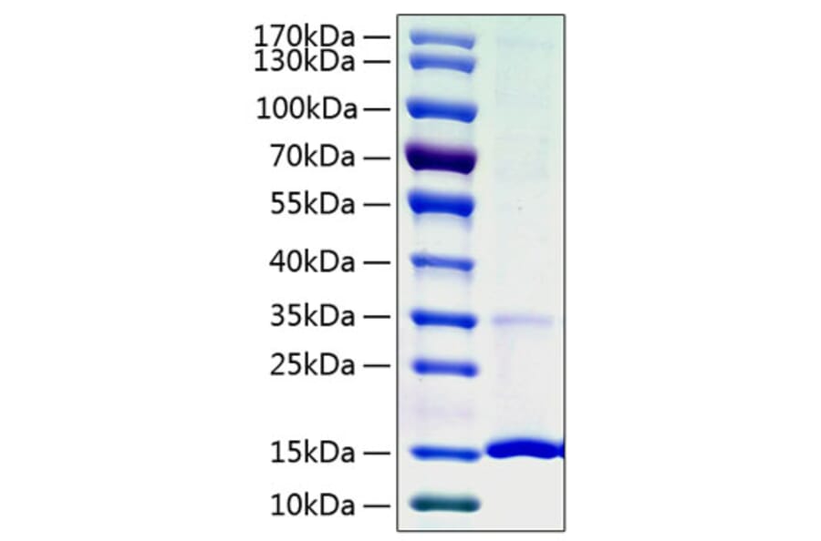 SDS-PAGE - Recombinant Human Cystatin S Protein (C-terminal His Tag) (A330516) - Antibodies.com