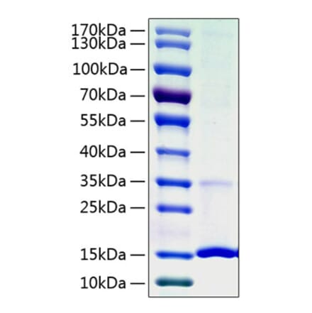 SDS-PAGE - Recombinant Human Cystatin S Protein (C-terminal His Tag) (A330516) - Antibodies.com