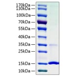 SDS-PAGE - Recombinant Human Cystatin S Protein (C-terminal His Tag) (A330516) - Antibodies.com