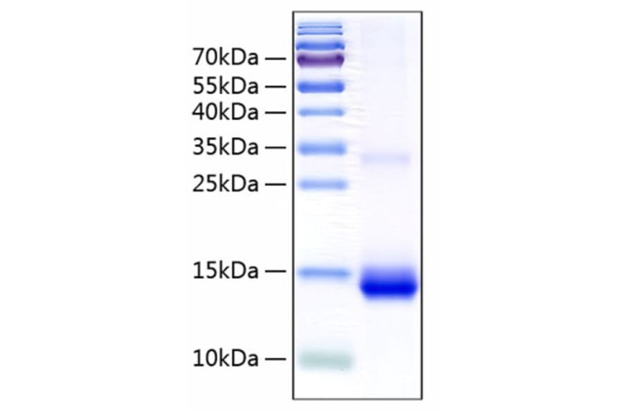 SDS-PAGE - Recombinant Human Cystatin SN/CST1 Protein (C-terminal His Tag) (A330518) - Antibodies.com