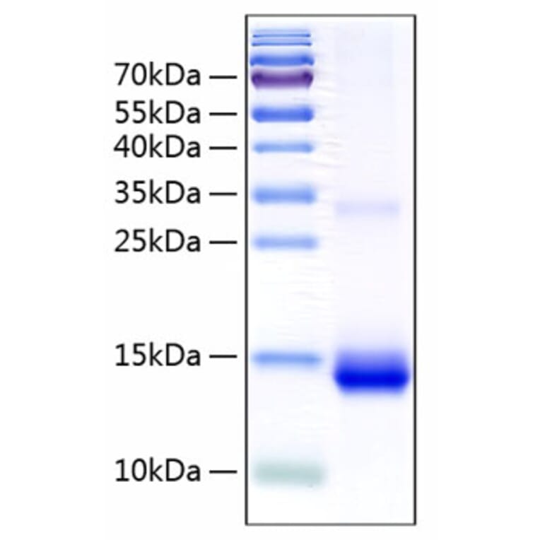 SDS-PAGE - Recombinant Human Cystatin SN/CST1 Protein (C-terminal His Tag) (A330518) - Antibodies.com