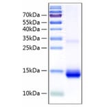 SDS-PAGE - Recombinant Human Cystatin SN/CST1 Protein (C-terminal His Tag) (A330518) - Antibodies.com