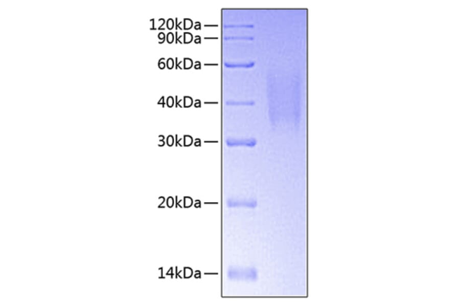 SDS-PAGE - Recombinant Human DcR1 Protein (C-terminal His Tag) (A330519) - Antibodies.com