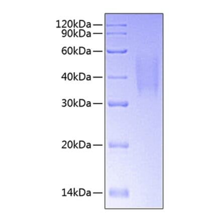 SDS-PAGE - Recombinant Human DcR1 Protein (C-terminal His Tag) (A330519) - Antibodies.com