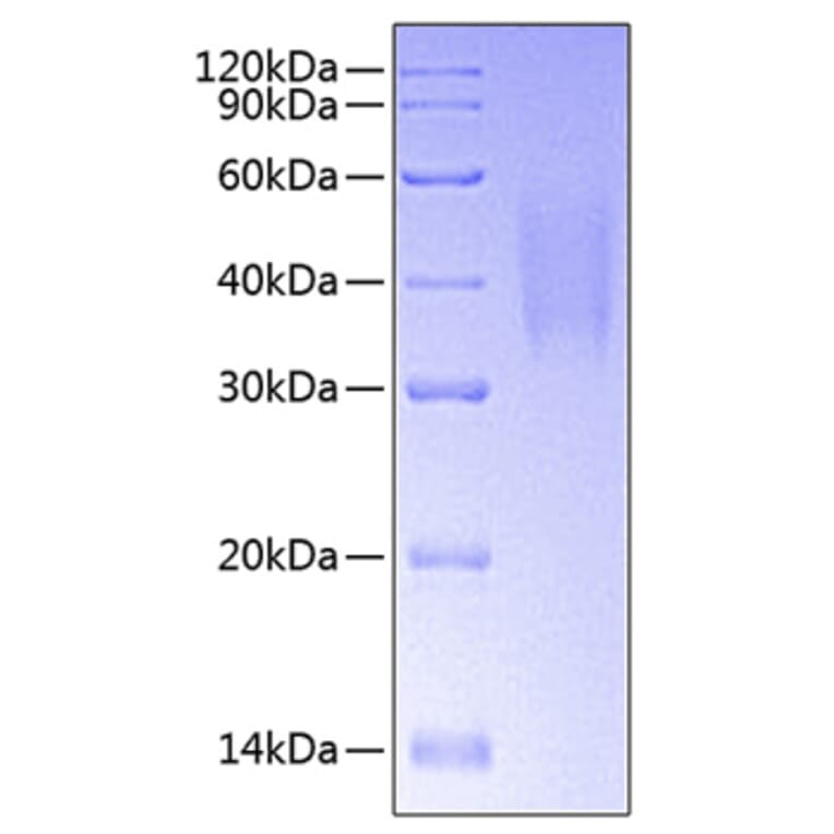 SDS-PAGE - Recombinant Human DcR1 Protein (C-terminal His Tag) (A330519) - Antibodies.com