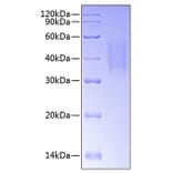 SDS-PAGE - Recombinant Human DcR1 Protein (C-terminal His Tag) (A330519) - Antibodies.com