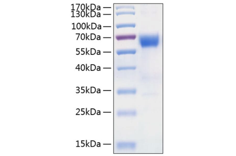 SDS-PAGE - Recombinant Human DcR2 Protein (C-terminal Human Fc and His Tag) (A330520) - Antibodies.com