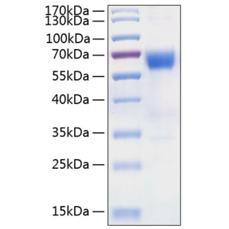 SDS-PAGE - Recombinant Human DcR2 Protein (C-terminal Human Fc and His Tag) (A330520) - Antibodies.com