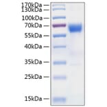 SDS-PAGE - Recombinant Human DcR2 Protein (C-terminal Human Fc and His Tag) (A330520) - Antibodies.com