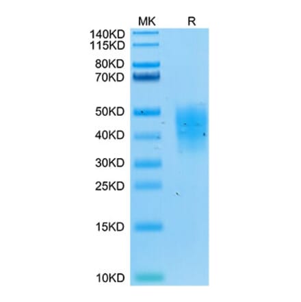 Tris-Bis PAGE - Recombinant Human DcR2 Protein (Biotin) (C-terminal His and Avi Tag) (A330521) - Antibodies.com