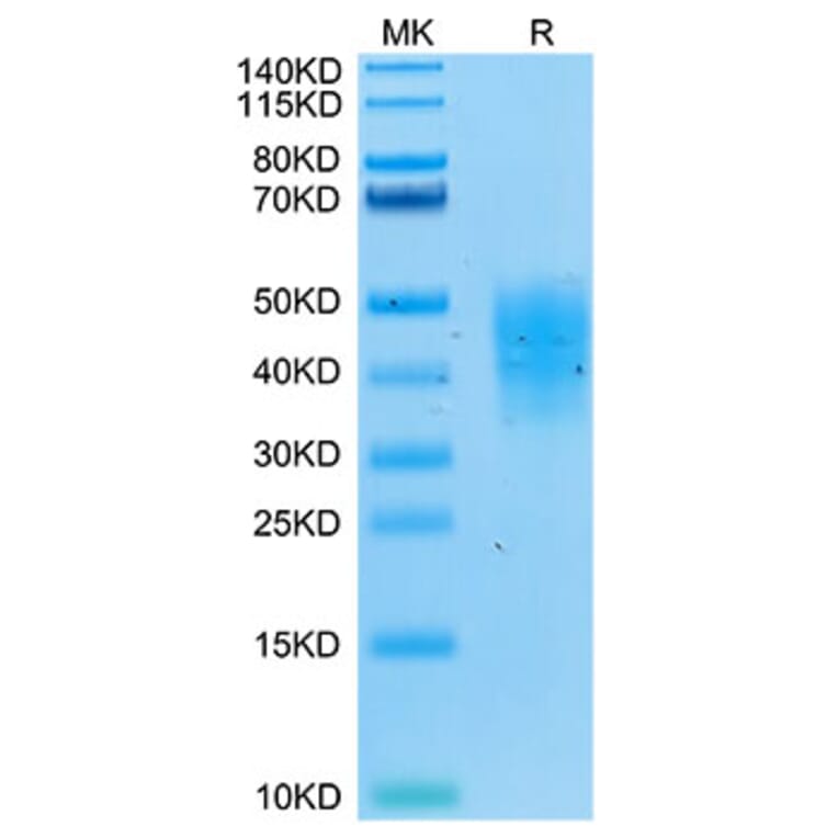 Tris-Bis PAGE - Recombinant Human DcR2 Protein (Biotin) (C-terminal His and Avi Tag) (A330521) - Antibodies.com