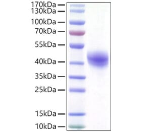 SDS-PAGE - Recombinant Human DC-SIGN Protein (C-terminal His Tag) (A330522) - Antibodies.com