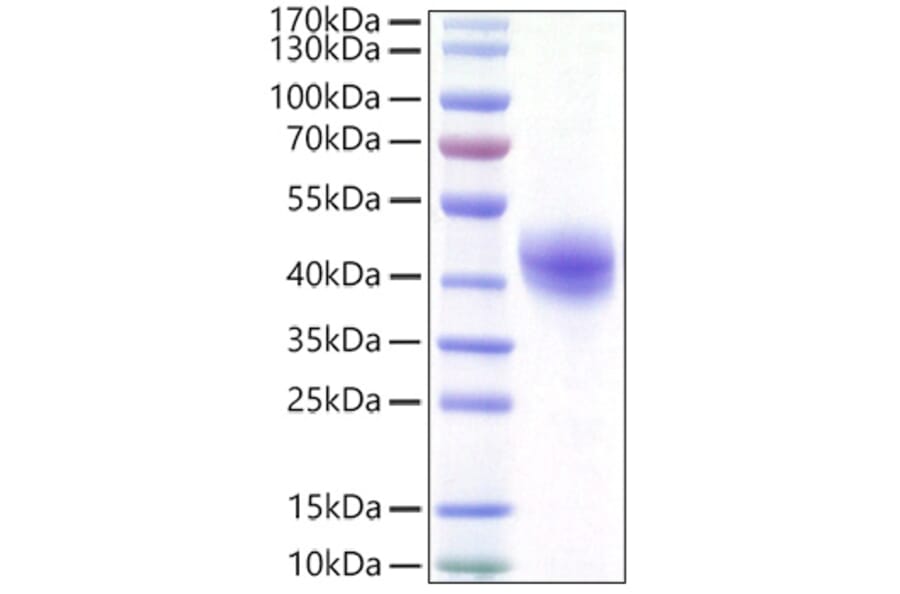 SDS-PAGE - Recombinant Human DC-SIGN Protein (C-terminal His Tag) (A330522) - Antibodies.com