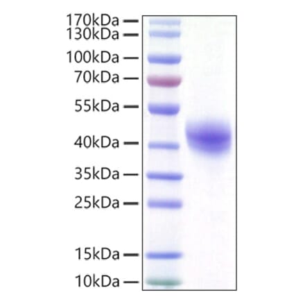 SDS-PAGE - Recombinant Human DC-SIGN Protein (C-terminal His Tag) (A330522) - Antibodies.com