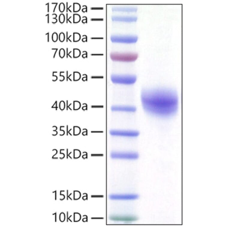 SDS-PAGE - Recombinant Human DC-SIGN Protein (C-terminal His Tag) (A330522) - Antibodies.com