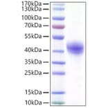 SDS-PAGE - Recombinant Human DC-SIGN Protein (C-terminal His Tag) (A330522) - Antibodies.com