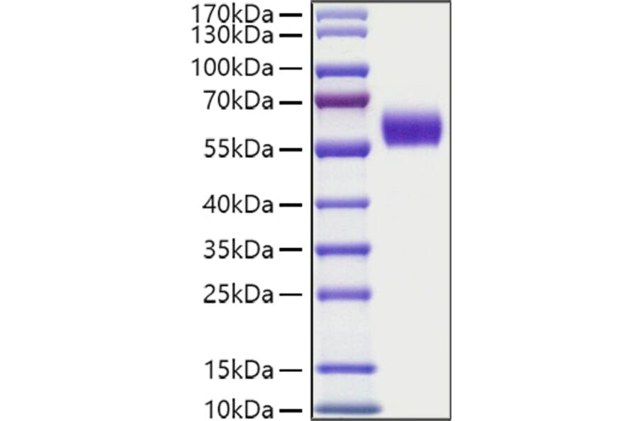 SDS-PAGE - Recombinant Human DDR1 Protein (C-terminal His Tag) (A330523) - Antibodies.com