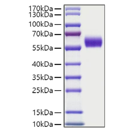 SDS-PAGE - Recombinant Human DDR1 Protein (C-terminal His Tag) (A330523) - Antibodies.com