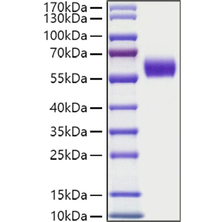 SDS-PAGE - Recombinant Human DDR1 Protein (C-terminal His Tag) (A330523) - Antibodies.com