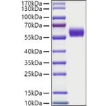 SDS-PAGE - Recombinant Human DDR1 Protein (C-terminal His Tag) (A330523) - Antibodies.com