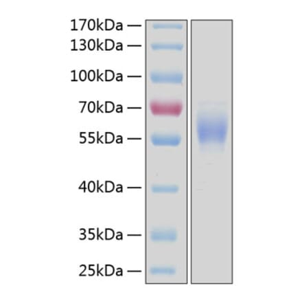 SDS-PAGE - Recombinant Human DDR2 Protein (C-terminal His Tag) (A330524) - Antibodies.com