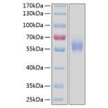 SDS-PAGE - Recombinant Human DDR2 Protein (C-terminal His Tag) (A330524) - Antibodies.com