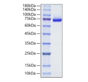 SDS-PAGE - Recombinant Human Decorin Protein (C-terminal Human Fc Tag) (A330525) - Antibodies.com
