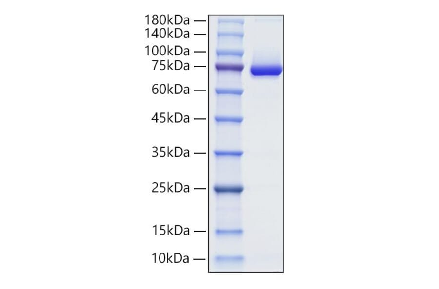 SDS-PAGE - Recombinant Human Decorin Protein (C-terminal Human Fc Tag) (A330525) - Antibodies.com