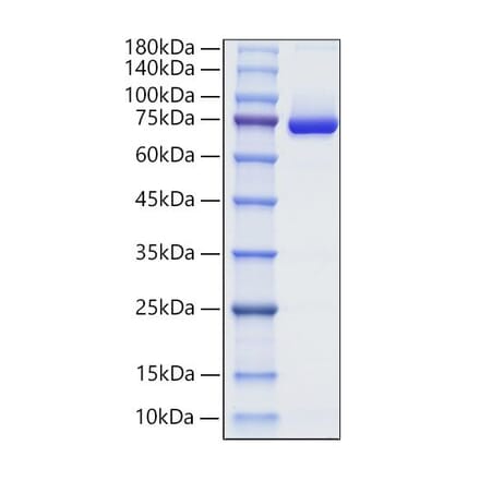 SDS-PAGE - Recombinant Human Decorin Protein (C-terminal Human Fc Tag) (A330525) - Antibodies.com