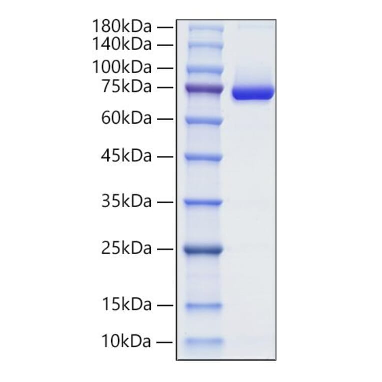 SDS-PAGE - Recombinant Human Decorin Protein (C-terminal Human Fc Tag) (A330525) - Antibodies.com