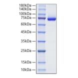 SDS-PAGE - Recombinant Human Decorin Protein (C-terminal Human Fc Tag) (A330525) - Antibodies.com