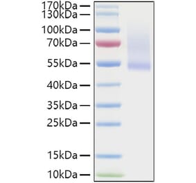 SDS-PAGE - Recombinant Human Decorin Protein (C-terminal His Tag) (A330526) - Antibodies.com