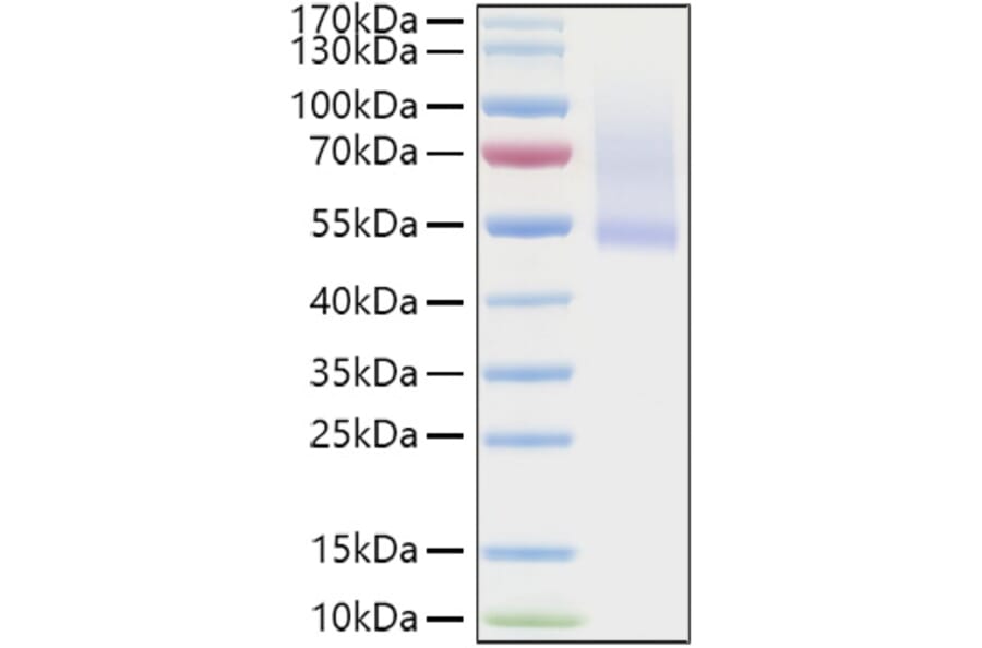 SDS-PAGE - Recombinant Human Decorin Protein (C-terminal His Tag) (A330526) - Antibodies.com