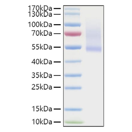 SDS-PAGE - Recombinant Human Decorin Protein (C-terminal His Tag) (A330526) - Antibodies.com