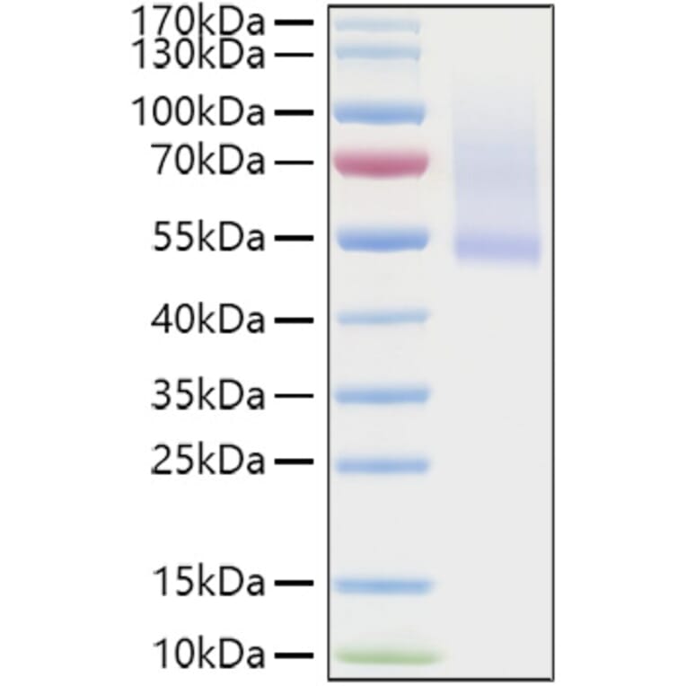 SDS-PAGE - Recombinant Human Decorin Protein (C-terminal His Tag) (A330526) - Antibodies.com