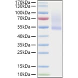 SDS-PAGE - Recombinant Human Decorin Protein (C-terminal His Tag) (A330526) - Antibodies.com