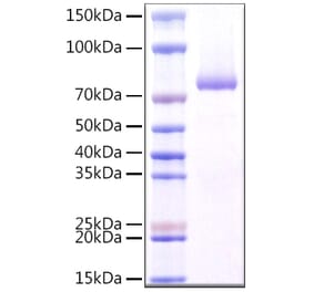 SDS-PAGE - Recombinant Human Dectin-1 Protein (N-terminal Rabbit Fc Tag) (A330527) - Antibodies.com