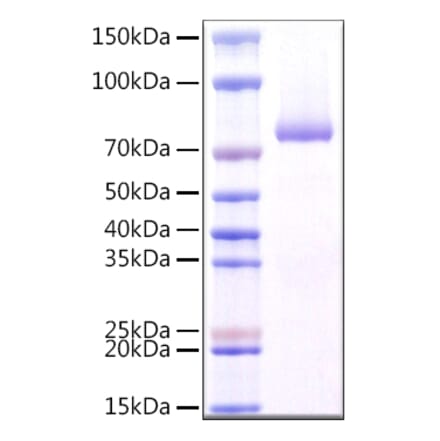 SDS-PAGE - Recombinant Human Dectin-1 Protein (N-terminal Rabbit Fc Tag) (A330527) - Antibodies.com